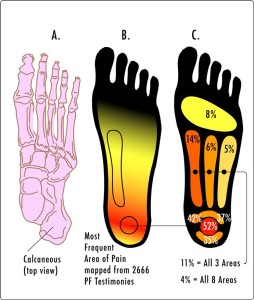 pain relief insoles