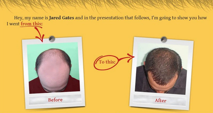 hair loss protocol